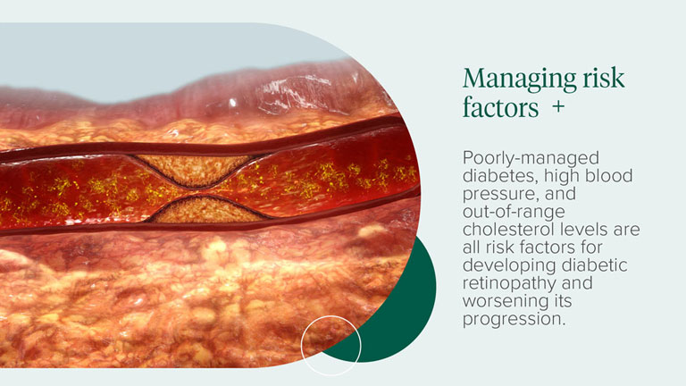 Managing risk factors