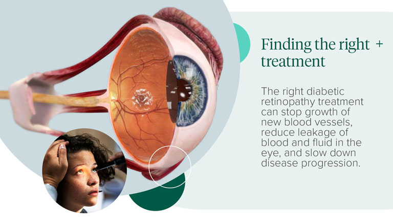 Finding the right treatment